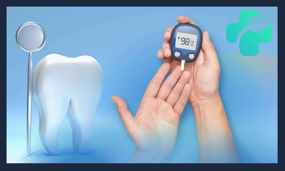 کاشت ایمپلنت افراد دیابتی