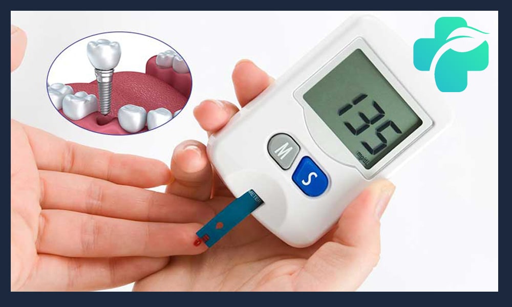 کاشت ایمپلنت افراد دیابتی