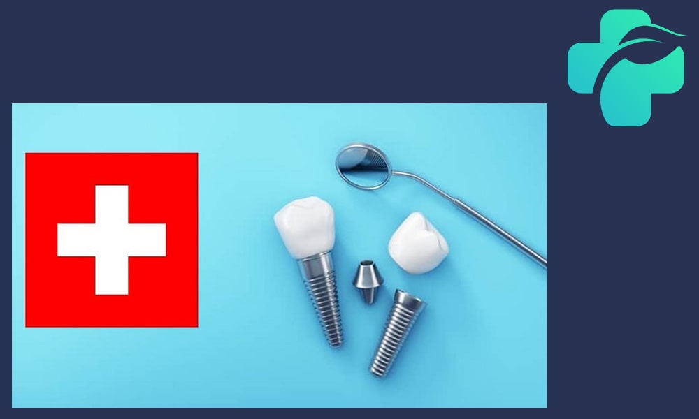 ایمپلنت سوئیسی