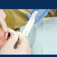 فلوراید تراپی