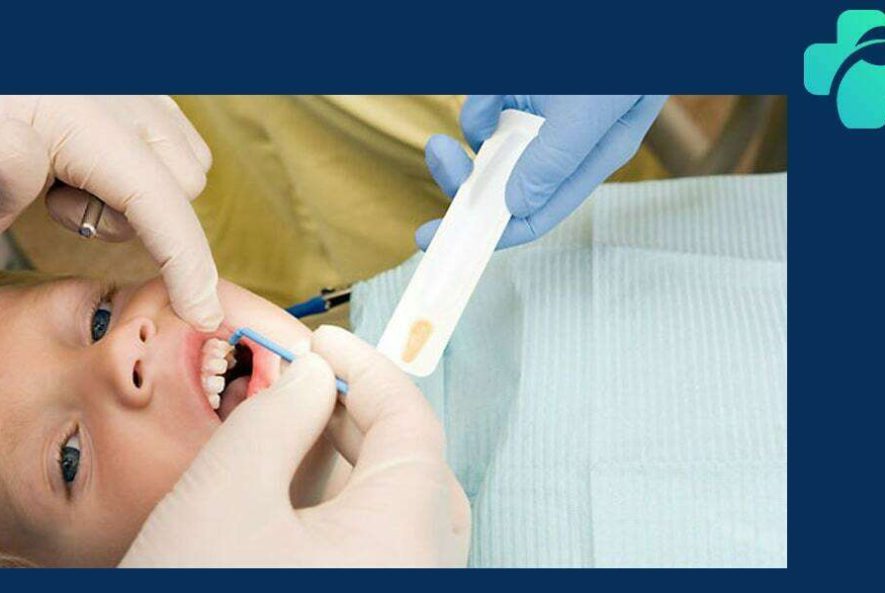 فلوراید تراپی