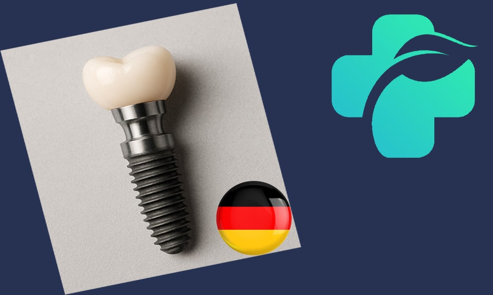ایمپلنت آلمانی