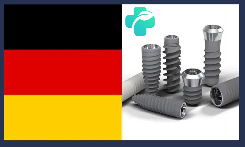 ایمپلنت آلمانی