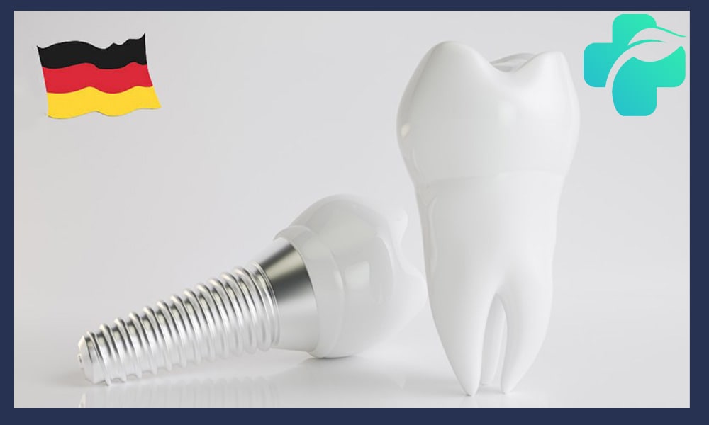 ایمپلنت آلمانی