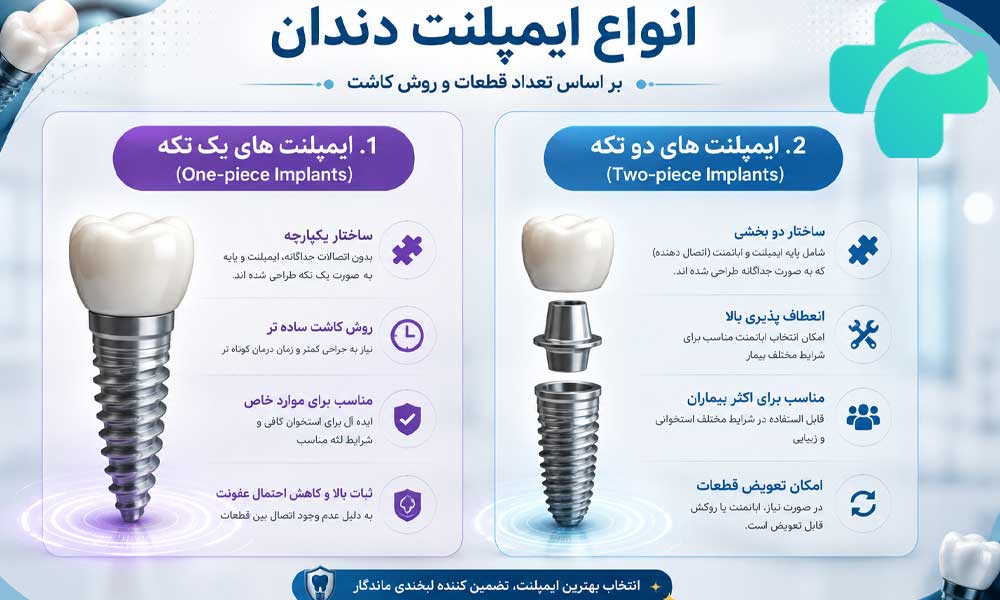 معرفی انواع ایمپلنت دندان