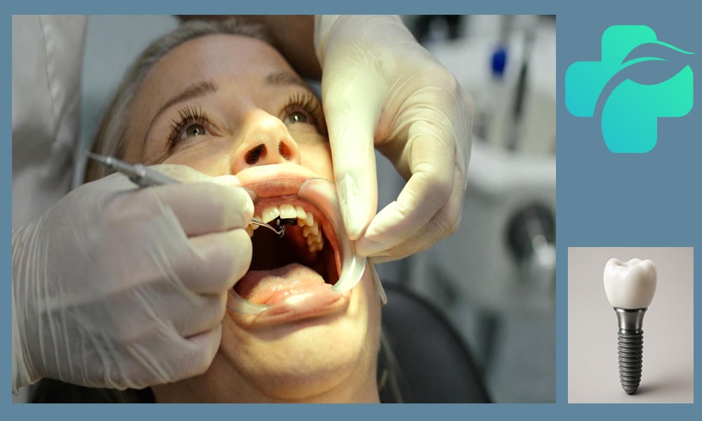ایمپلنت دندان دیجیتال چیست؟