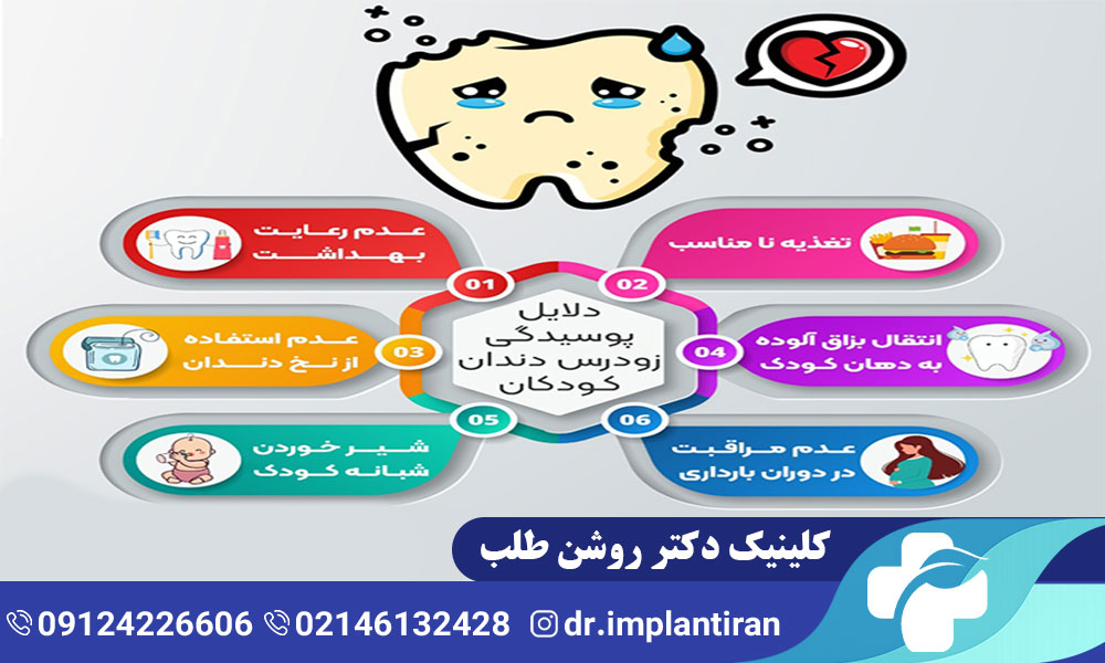 دلایل خرابی و پوسیدگی دندان کودکان