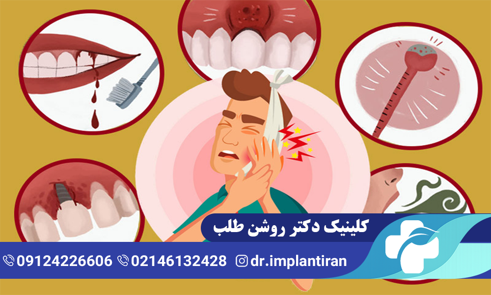راه های درمان درد بعد ایمپلنت