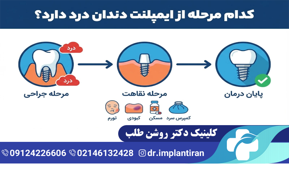 راه های درمان درد ایمپلنت دندان