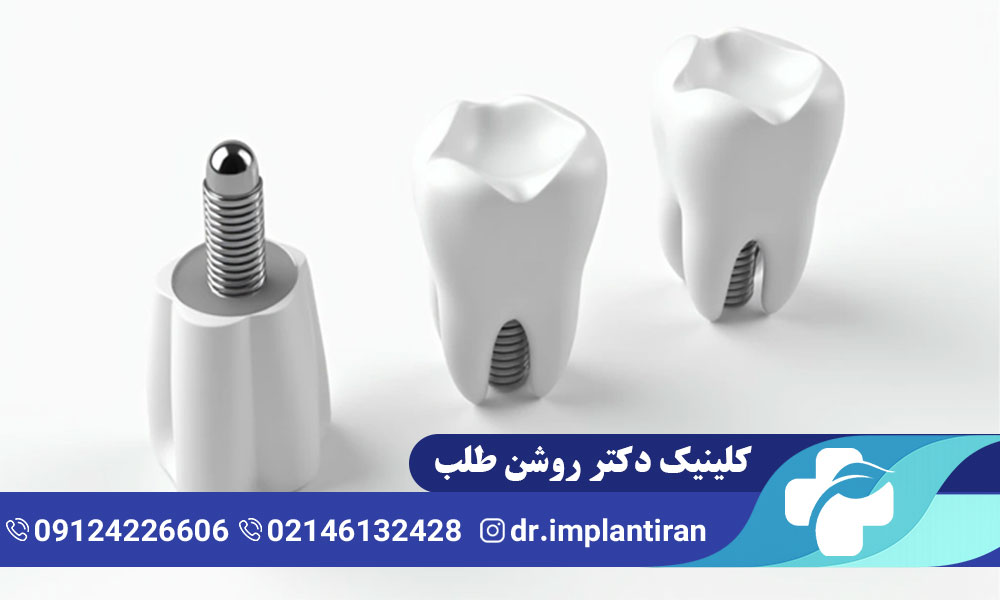 ایمپلنت دندان با بیهوشی