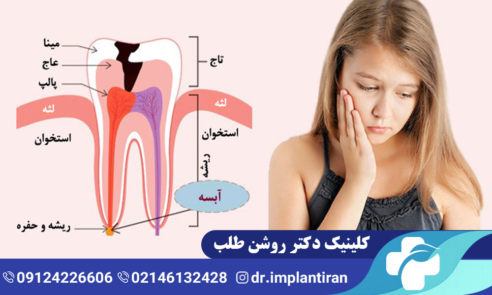 روش های درمان عفونت دندان کودکان