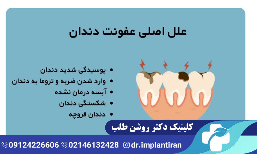 روش های درمان عفونت دندان کودکان