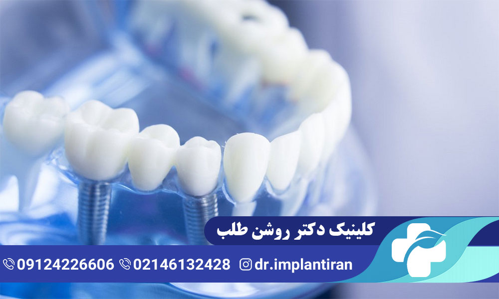 جراحی لثه برای ایمپلنت