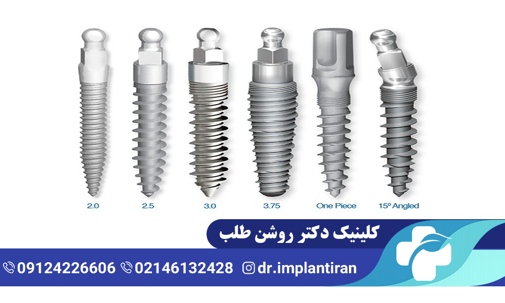 فیکسچر ایمپلنت چیست و چه کاربردی دارد؟