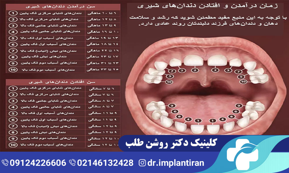 افتادن دندان شیری: ترتیب افتادن دندان شیری