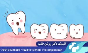 افتادن دندان شیری: ترتیب افتادن دندان شیری