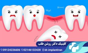 افتادن دندان شیری: ترتیب افتادن دندان شیری