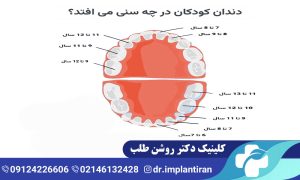 افتادن دندان شیری: ترتیب افتادن دندان شیری