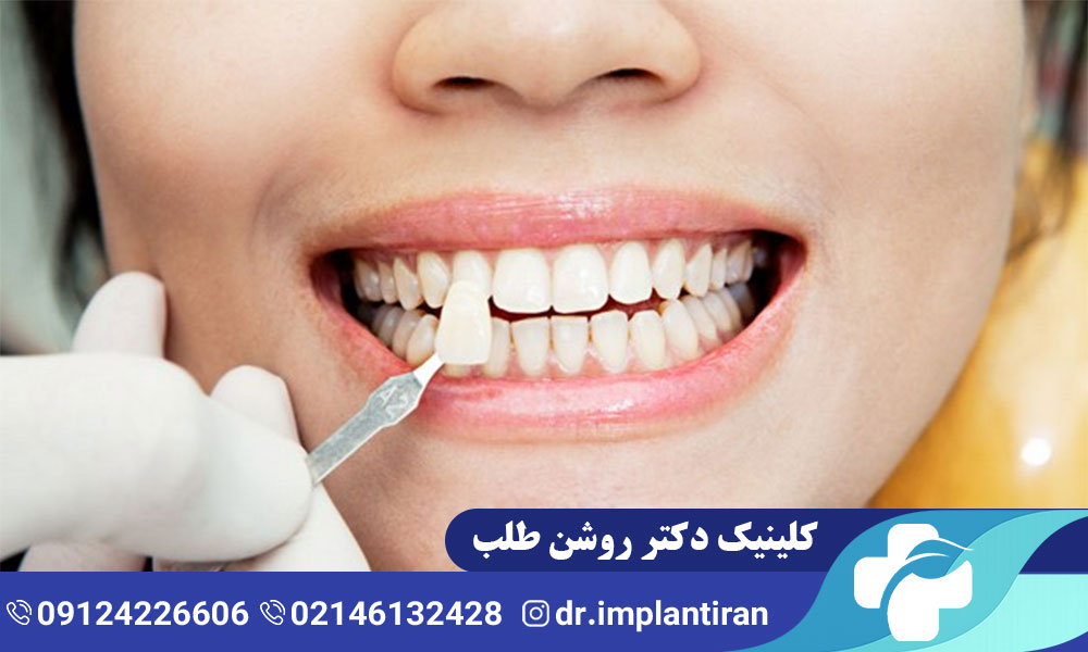 ونیر دندان چیست؟ مراحل، مزایا و معایب