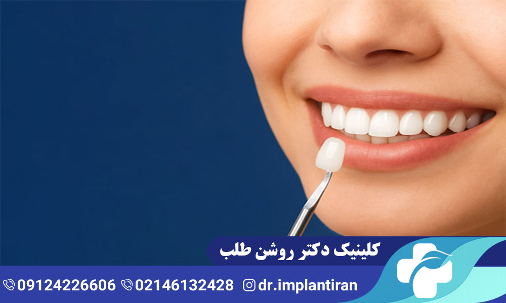 ونیر دندان چیست؟ مراحل، مزایا و معایب