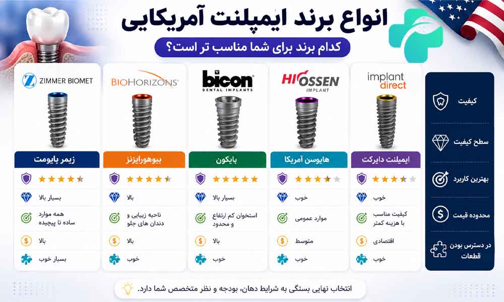 ایمپلنت آمریکایی