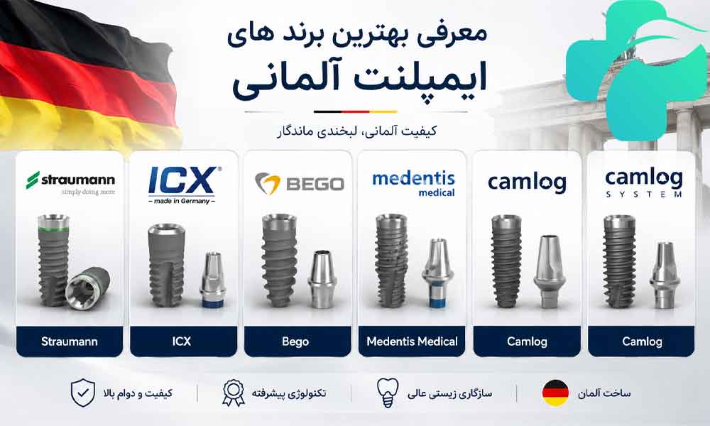 ایمپلنت آلمانی