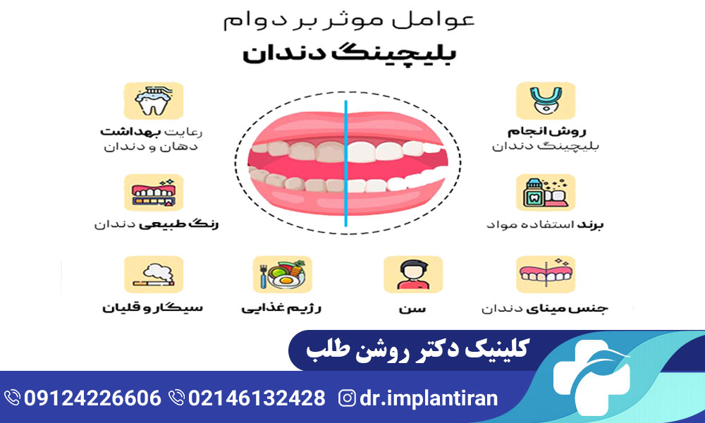 بلیچینگ دندان عصب کشی شده