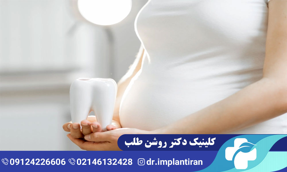 ایمپلنت در بارداری