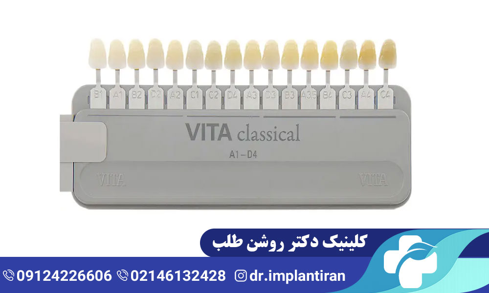 معرفی انواع لمینت دندان