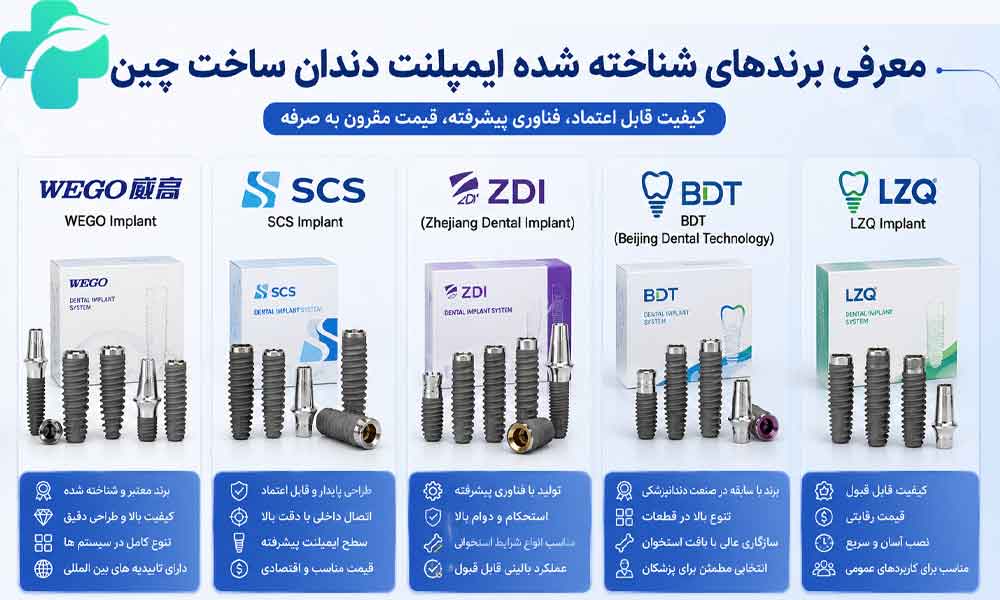 ایمپلنت چینی