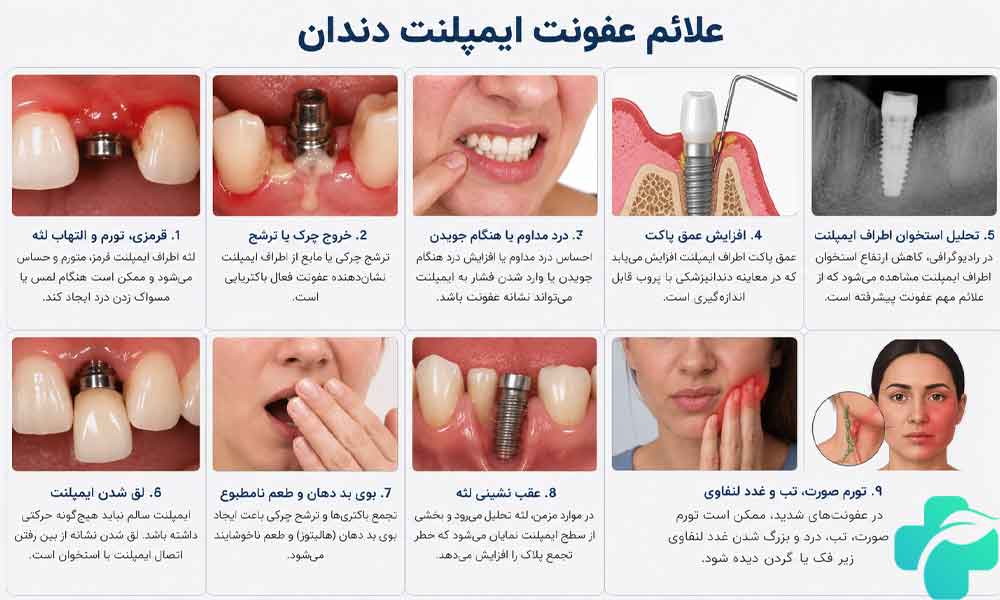 عفونت ایمپلنت دندان