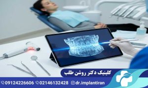 اسکن سه بعدی دندان برای ایمپلنت