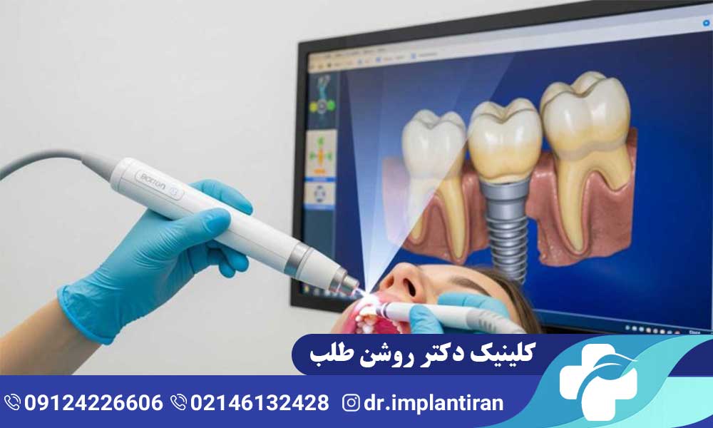 اسکن سه بعدی دندان برای ایمپلنت