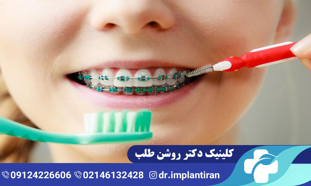 ارتودنسی کودکان