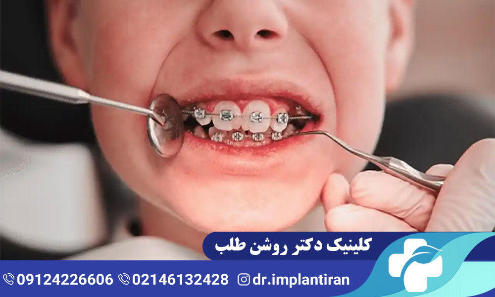 ارتودنسی کودکان