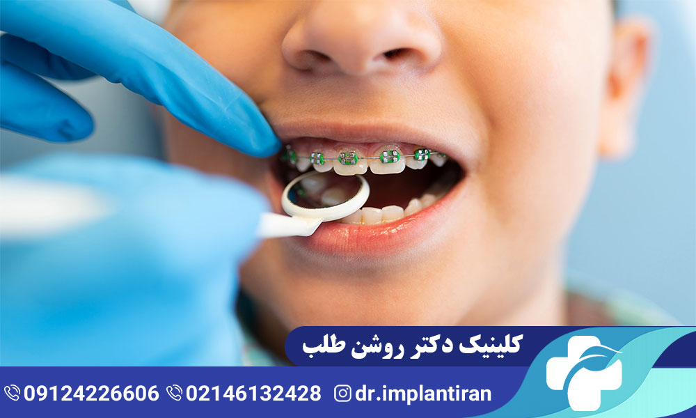 ارتودنسی کودکان