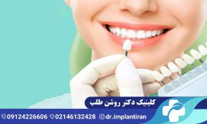 عمر لمینت دندان