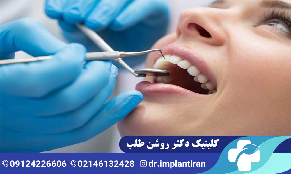 لمینت سرامیکی یا کامپوزیت