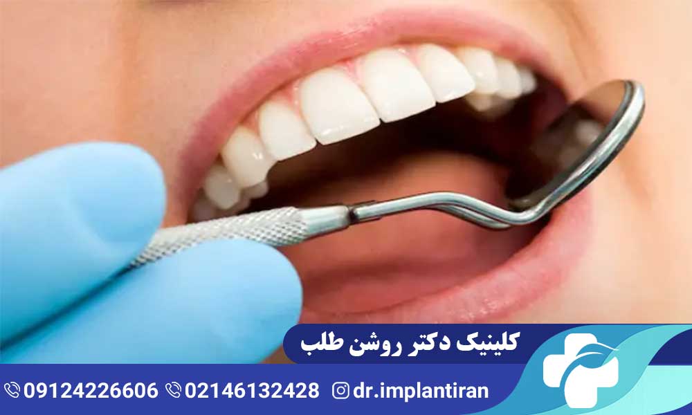 لمینت سرامیکی یا کامپوزیت