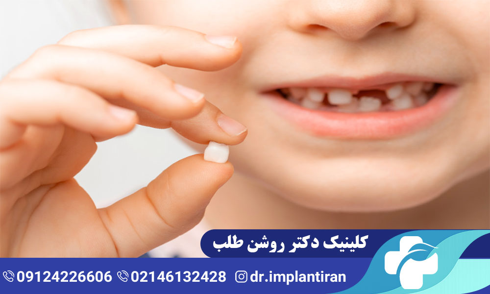 علت دیر افتادن دندان شیری