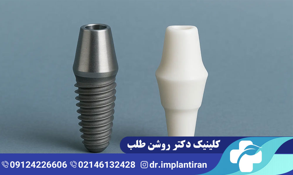 تفاوت ایمپلنت تیتانیومی و زیرکونیا
