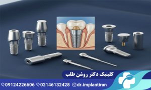 ایمپلنت تیتانیوم