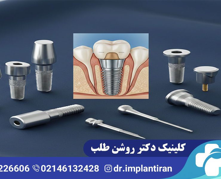 ایمپلنت تیتانیوم