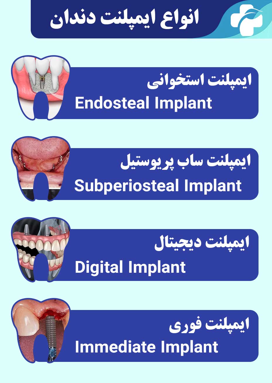 انواع ایمپلنت دندان و کاربردهای آن