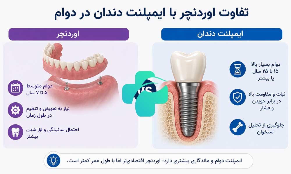 تفاوت اوردنچر با ایمپلنت