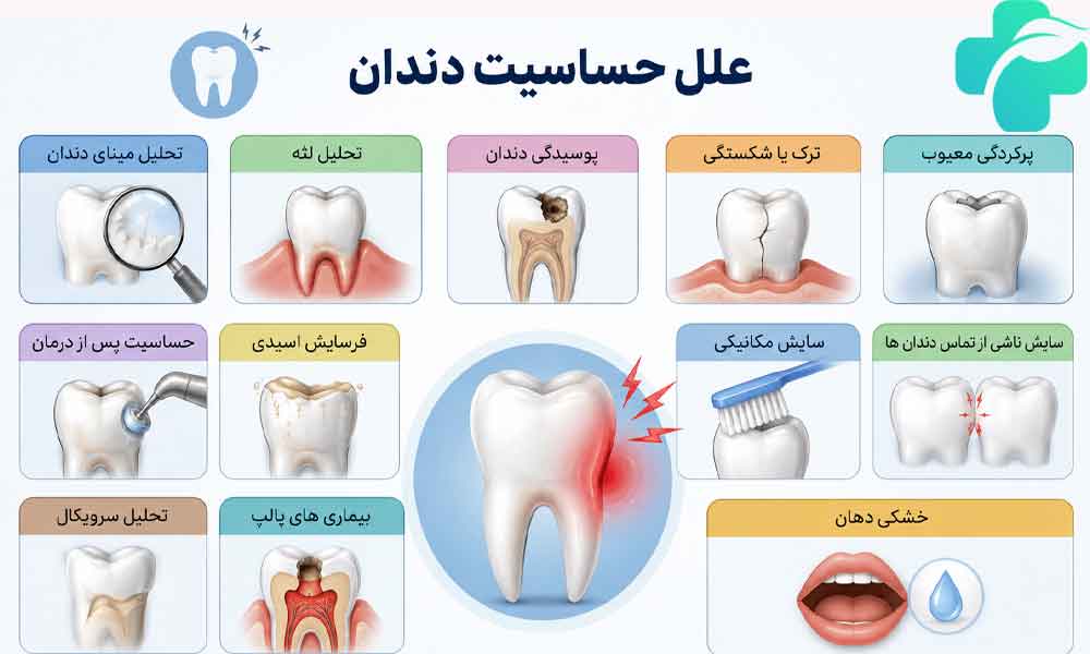 علل حساسیت دندان