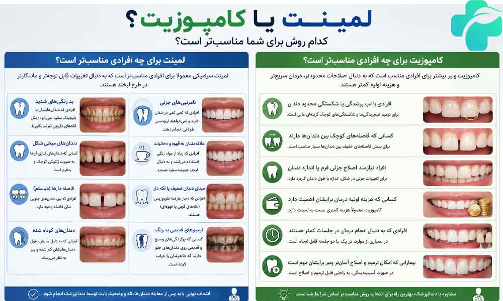 تفاوت لمینت و کامپوزیت