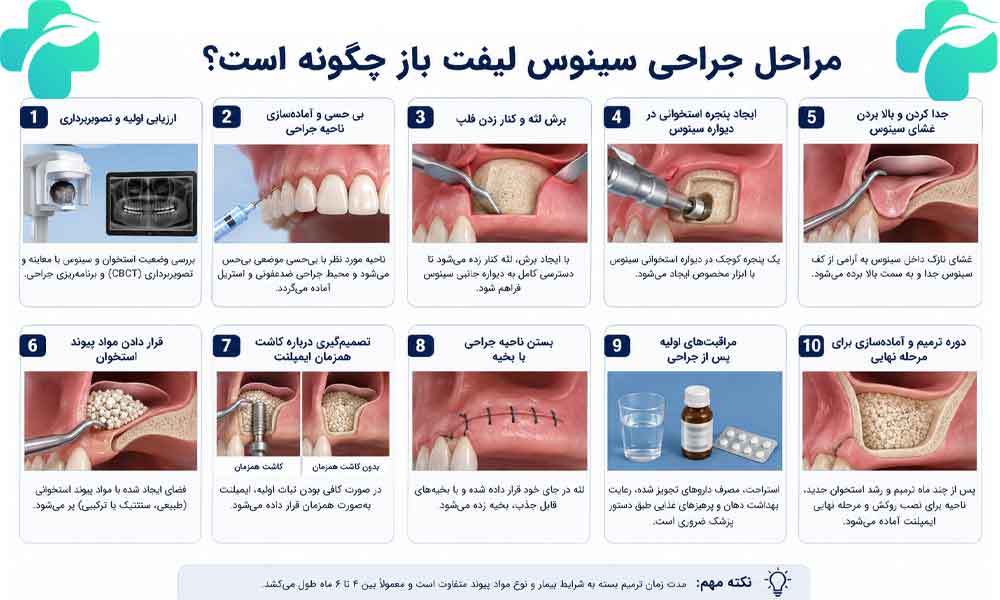 جراحی سینوس لیفت باز