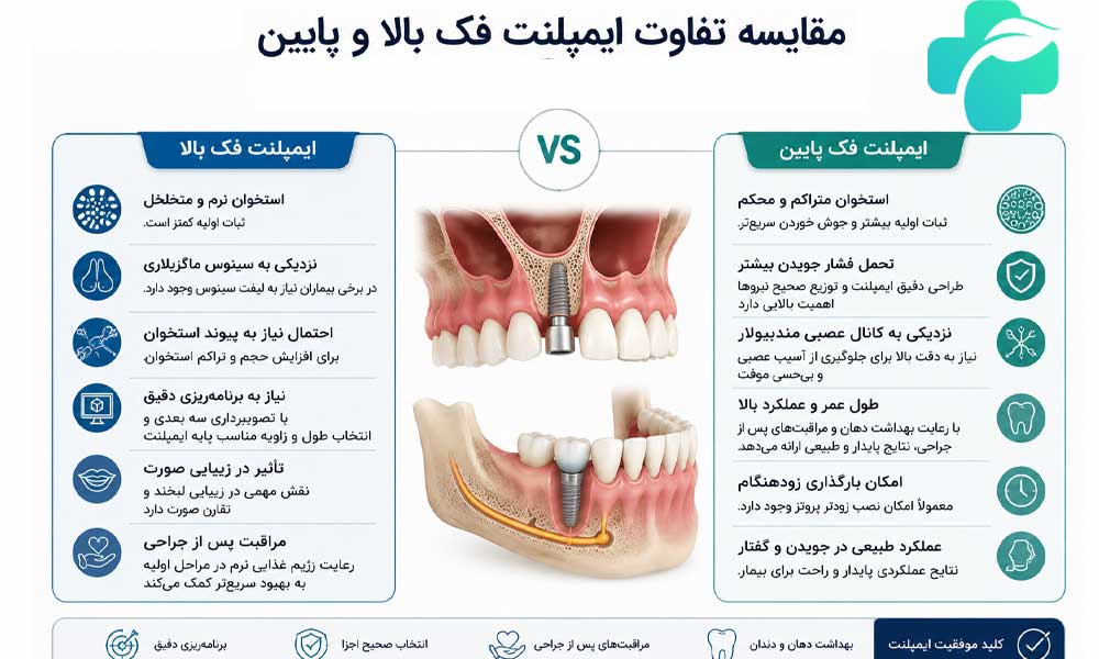 تفاوت ایمپلنت فک بالا و پایین