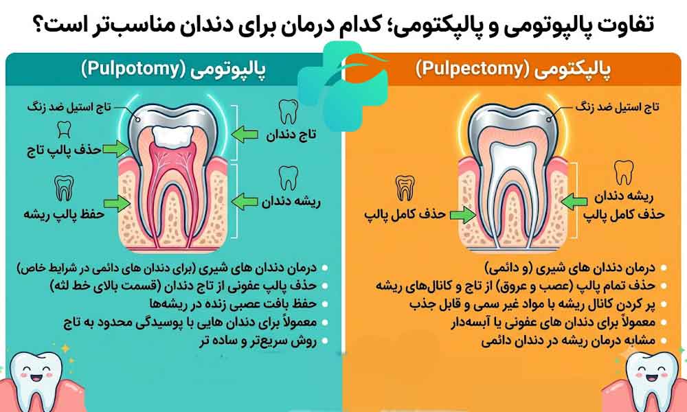 تفاوت پالپوتومی و پالپکتومی